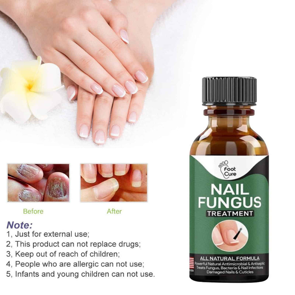 10ml Nail Fungal Infection Treatment Damaged Broken Nail