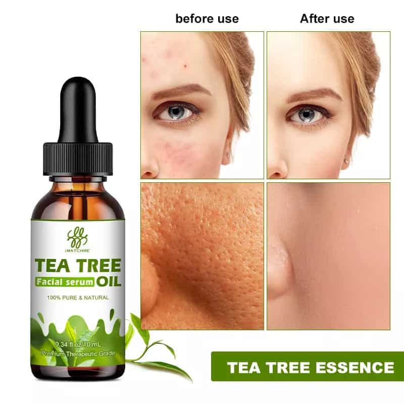 Tea Tree Oil Face Serum