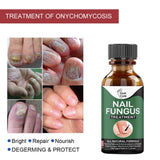 10ml Nail Fungal Infection Treatment Damaged Broken Nail